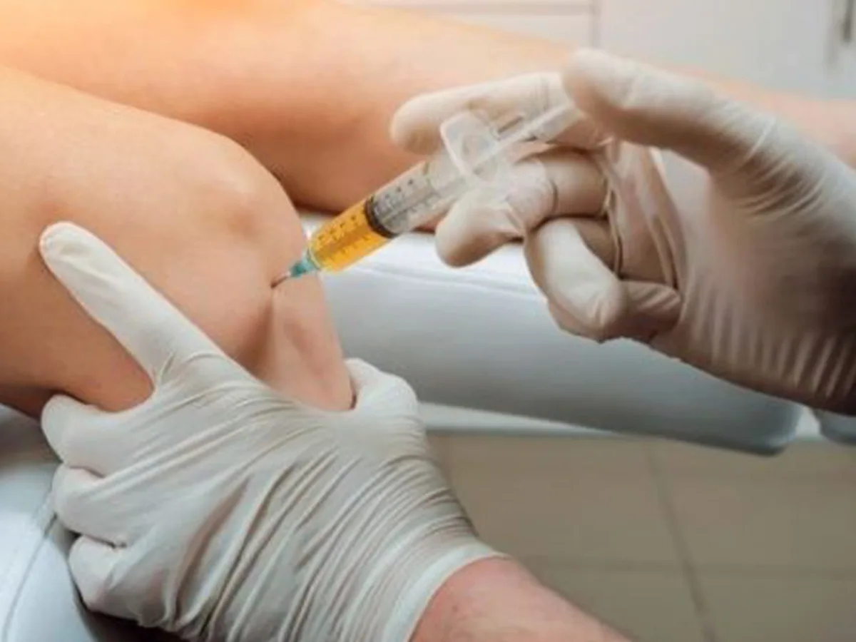 Infiltrazione intra-articolare del ginocchio eseguita in ambulatorio